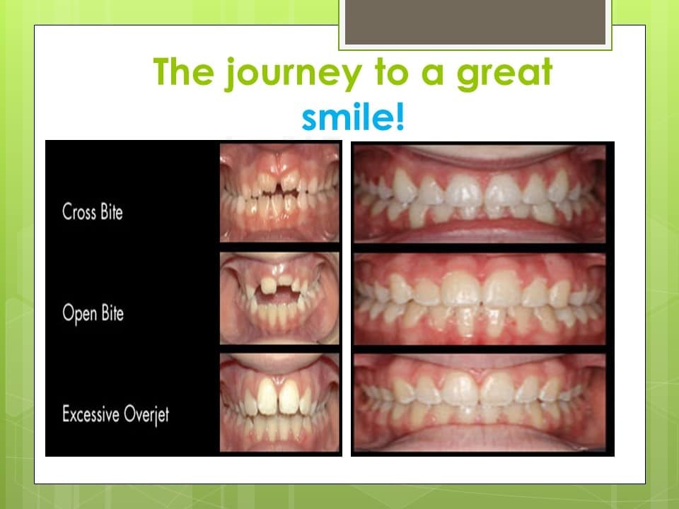 Slide4 1