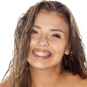 Young woman smiling brightly, displaying healthy teeth against white background for orthodontics dental practice.